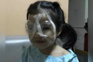 Menina de 4 anos faz cirurgia nos olhos após uso excessivo de celular (Crédito: Reprodução/Facebook)