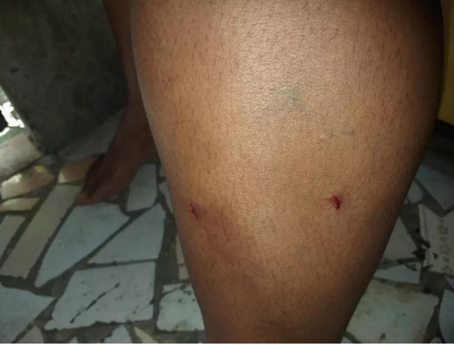 Mulher ficou ferida após ser atacada por porco em São Vicente, SP — Foto: Arquivo pessoal