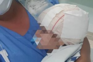 Criança é atacada por pitbull em Limeira