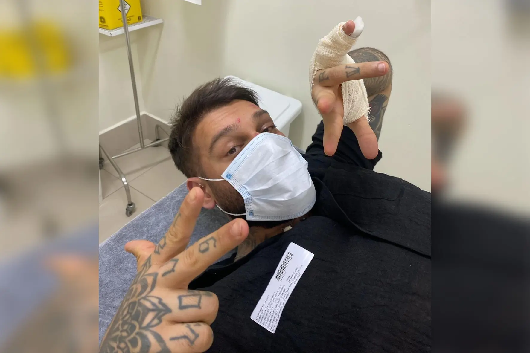 Lucas Lucco preocupa fãs após aparecer com o rosto machucado: 'Bebi demais'