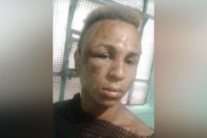 'Pisotearam meu rosto', afirma mulher trans que foi agredida por homens no centro de SP