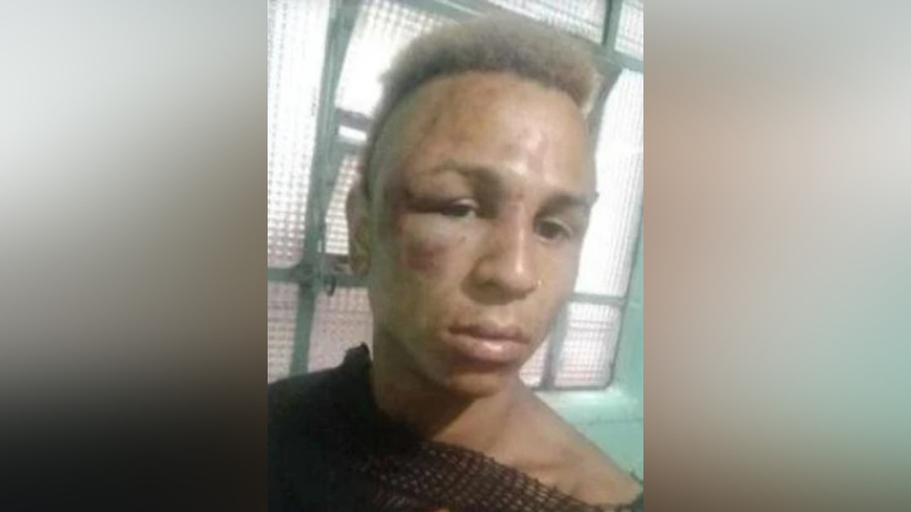 'Pisotearam meu rosto', afirma mulher trans que foi agredida por homens no centro de SP