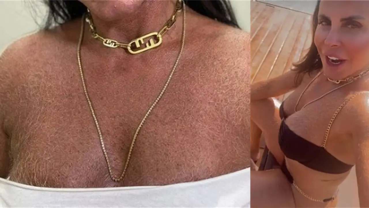 Gretchen rebate piadas sobre peito peludo
