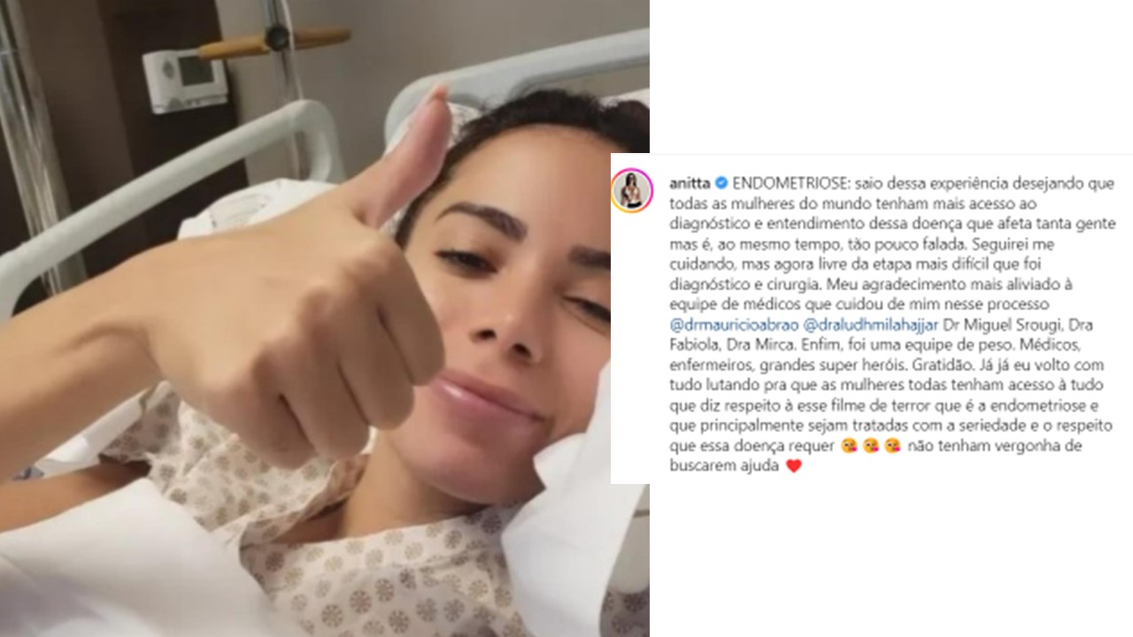 Anitta recebe alta após cirurgia de endometriose