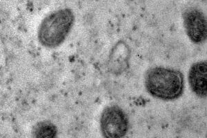 Casos de varíola dos macacos caem no Brasil, mas riscos ainda existem