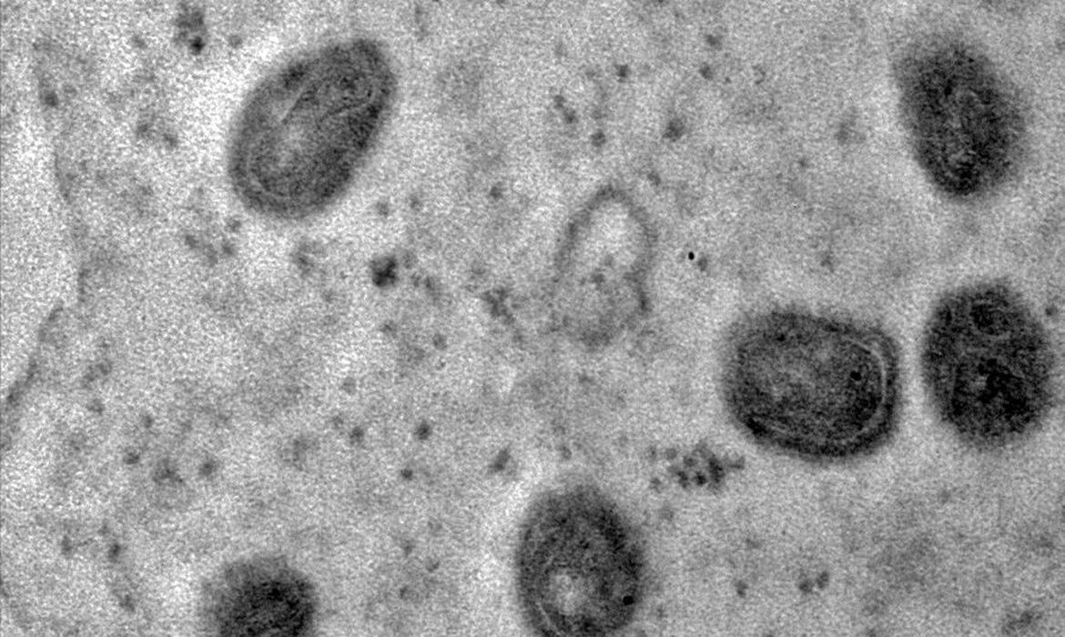 Casos de varíola dos macacos caem no Brasil, mas riscos ainda existem