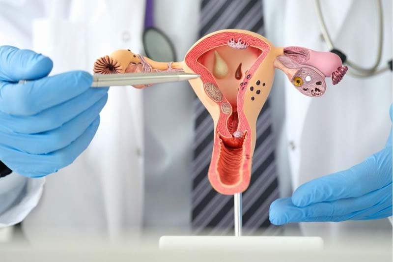 Câncer de colo do útero é o 3º tipo mais incidente entre mulheres; papanicolau é prevenção
