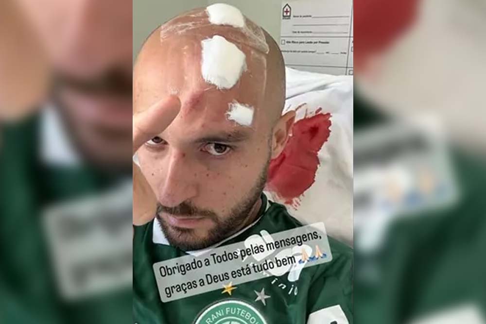 Régis, meia do Guarani, recebe alta após ser atingido por chuteira na cabeça