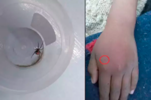 Criança deixa aranha picar a própria mão para tentar virar o Homem-Aranha