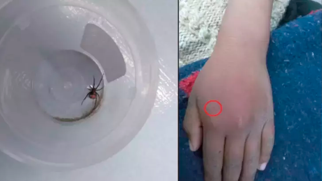 Criança deixa aranha picar a própria mão para tentar virar o Homem-Aranha