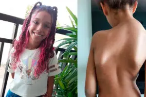 Amigos fazem bingo solidário para menina de 10 anos com doença rara, em Limeira