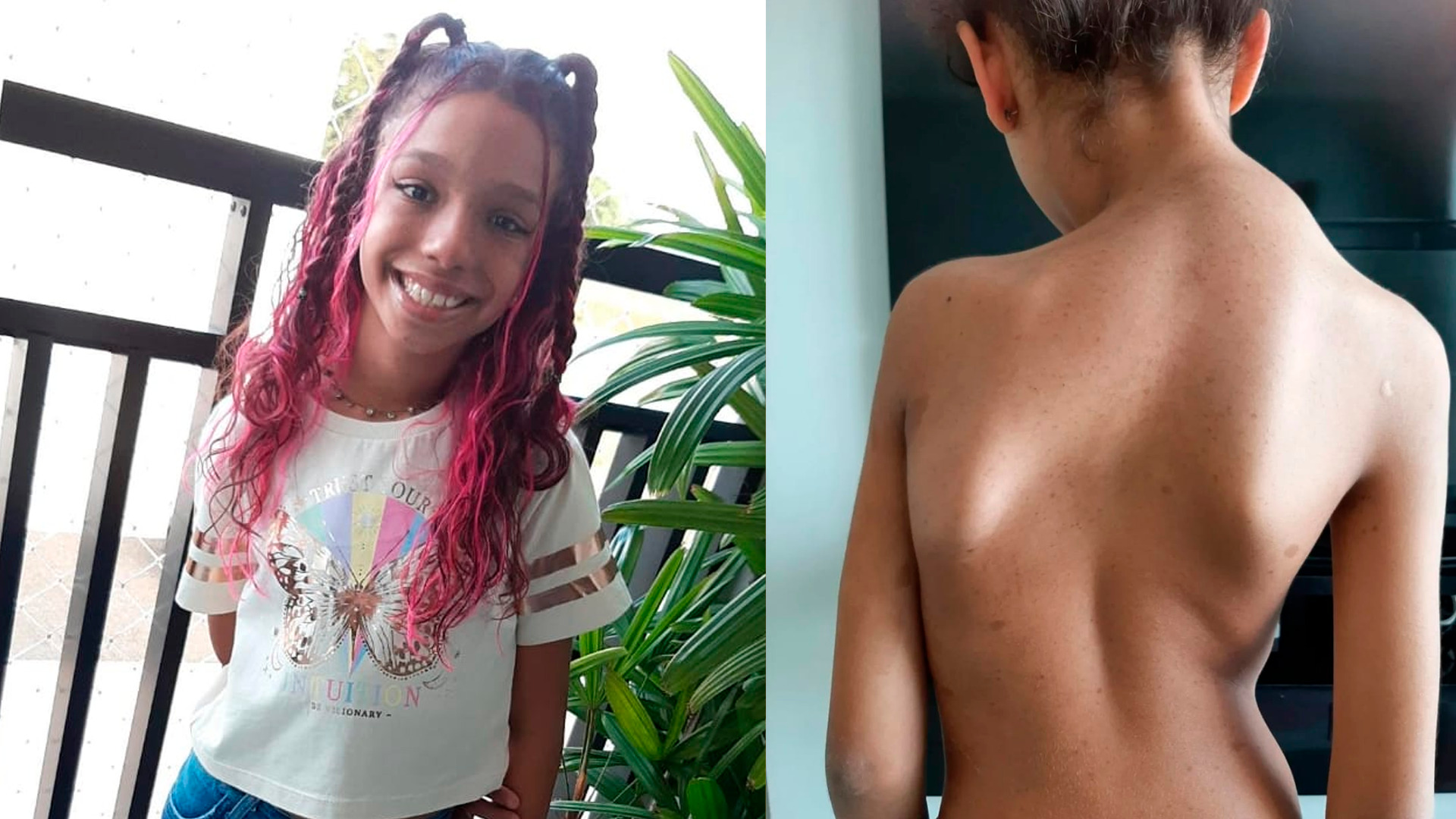 Amigos fazem bingo solidário para menina de 10 anos com doença rara, em Limeira