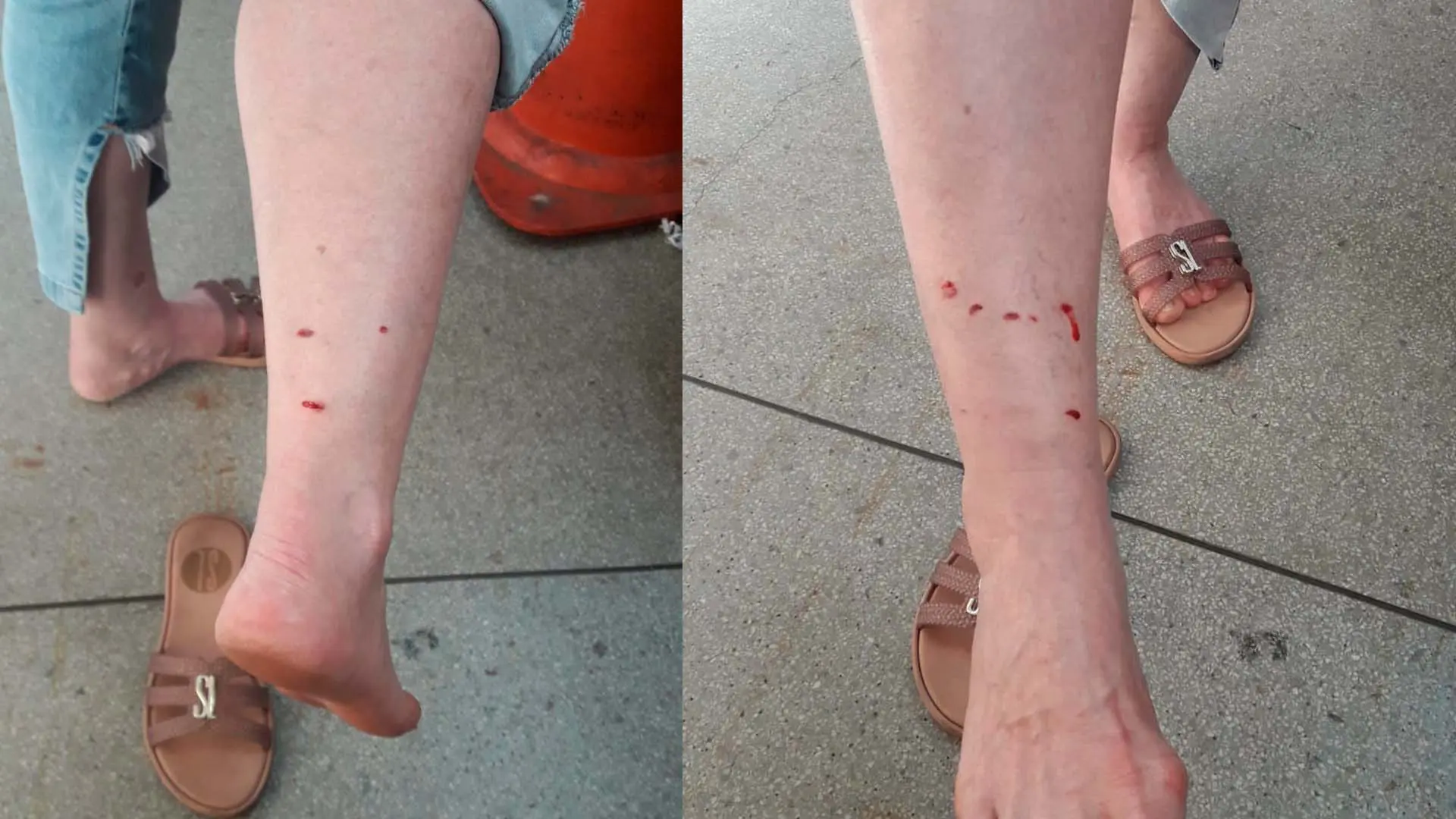 Mais uma mulher é atacada por cachorros soltos no Jardim Palmeiras, em Limeira