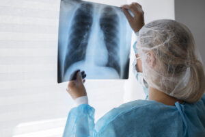 Limeira registra 64 casos de tuberculose
