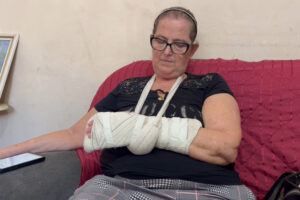 Sem energia e no escuro, mulher cai, quebra o braço e registra boletim contra Elektro, em Limeira