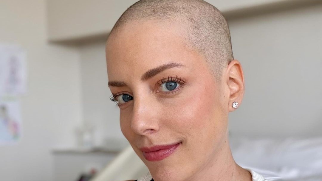 Filha de Roberto Justus raspa o cabelo em tratamento contra a leucemia