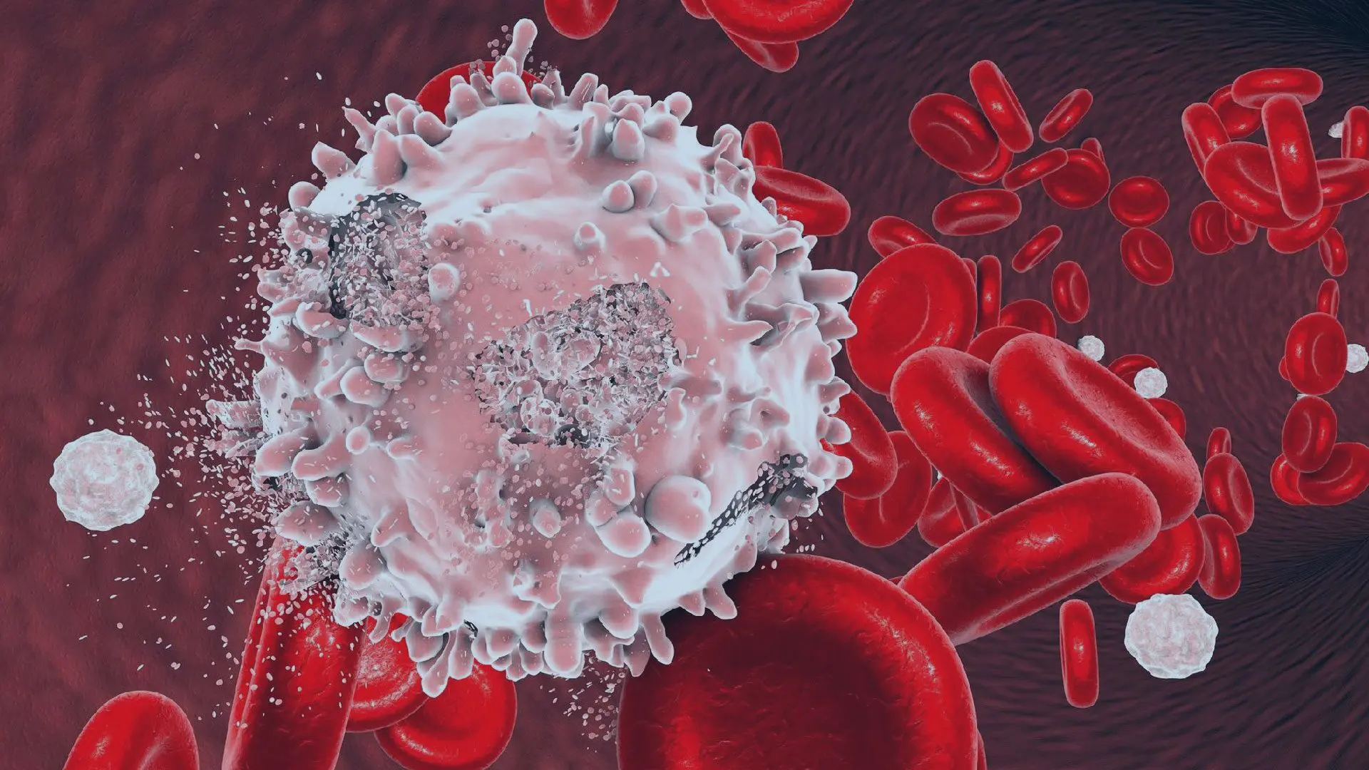 Fevereiro Laranja Leucemia é um dos 10 tipos de câncer mais comuns no país
