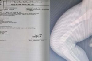 Entenda o caso do bebê de 6 meses espancado pelo pai, em Limeira