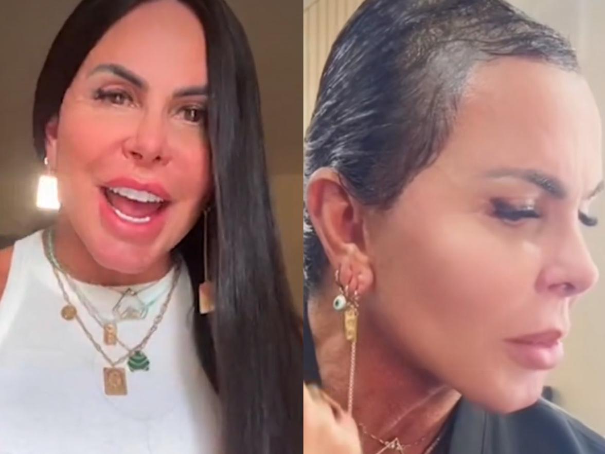 Gretchen tira mega hair e mostra realidade da alopecia