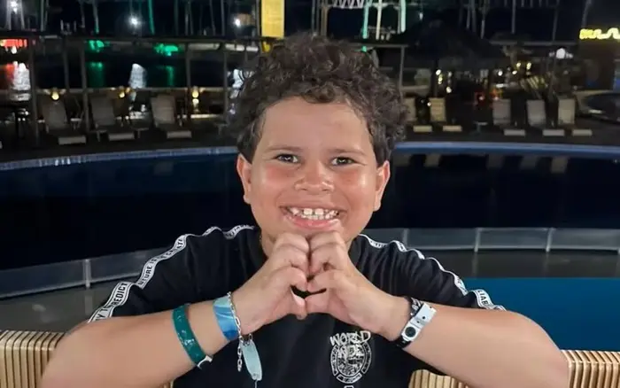 Filho de prefeito tem o rosto desfigurado após ataque de cachorro 1