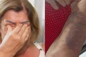 Professora idosa é espancada por família de aluno de sete anos