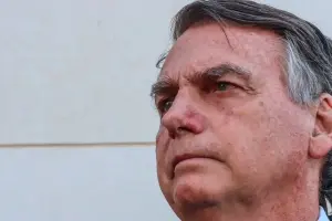 Bolsonaro é internado após apresentar dor abdominal