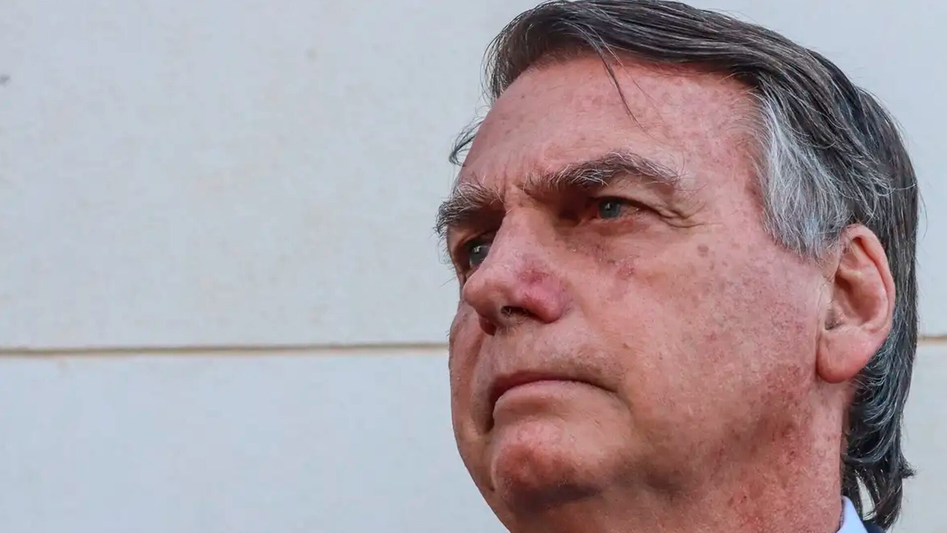 Bolsonaro é internado após apresentar dor abdominal