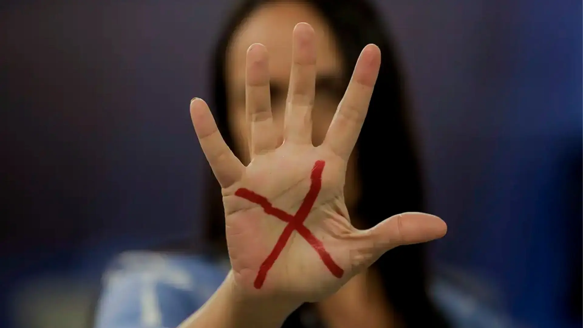 Mulheres vítimas de violência podem ter reconstrução dentária pelo SUS
