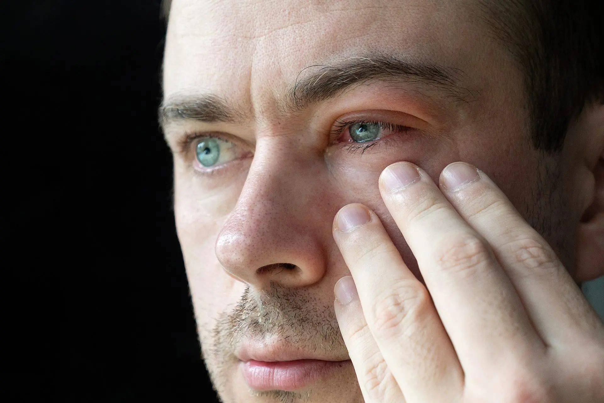 O que é conjuntivite Inflamação nos olhos atinge de bebês a idosos