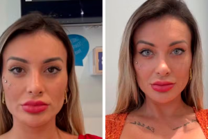 Andressa Urach relata arrependimento após cirurgia para mudar cor dos olhos
