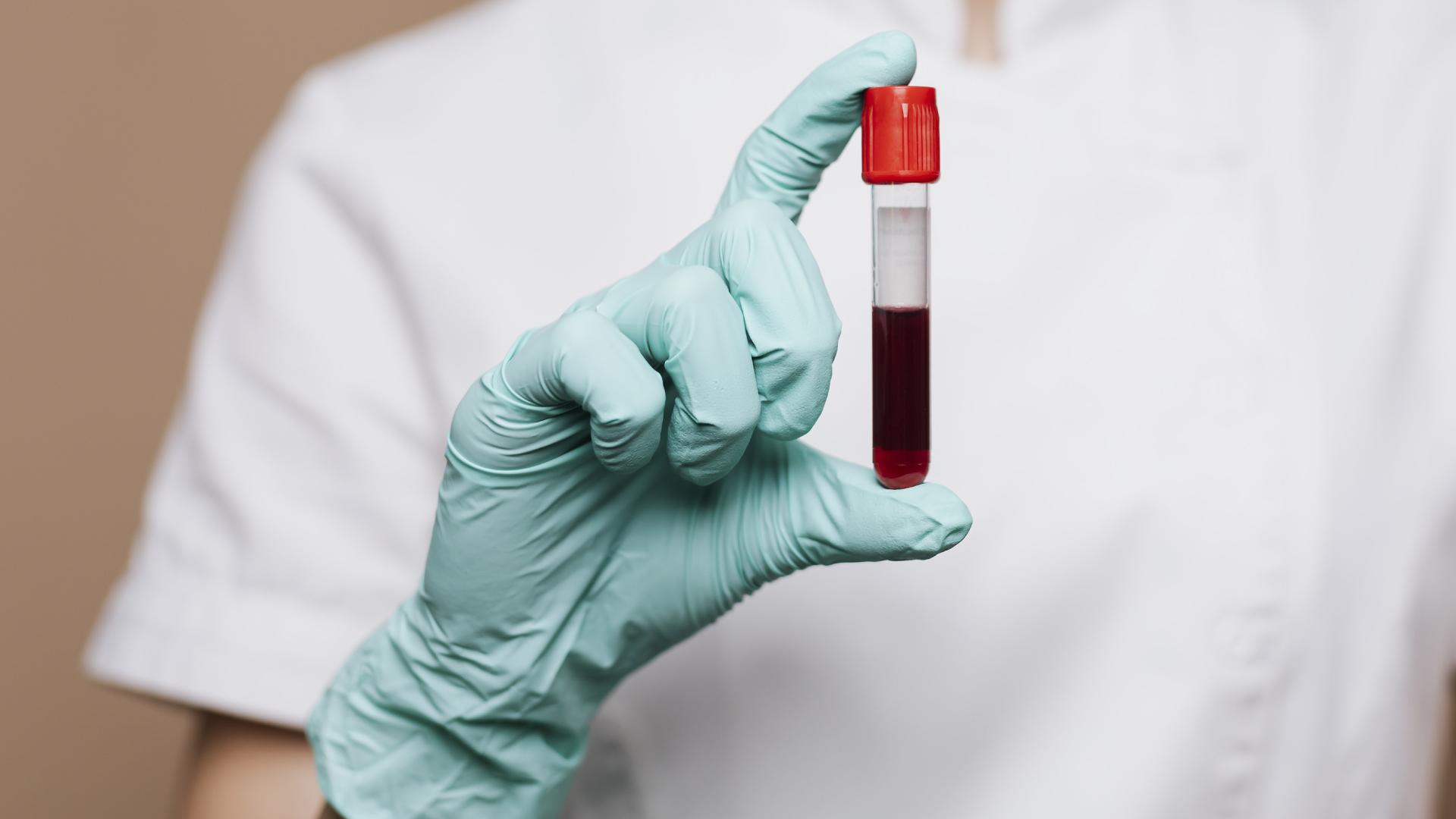 Santa Casa de Limeira alerta para situação crítica no banco de sangue