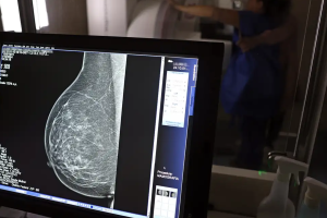 Ministério da Saúde passa a recomendar mamografia a partir dos 40 anos