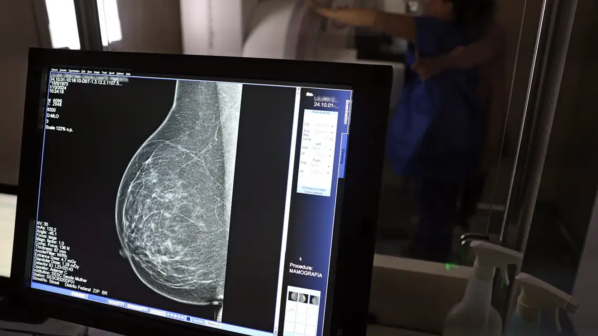 Ministério da Saúde passa a recomendar mamografia a partir dos 40 anos