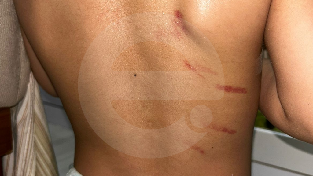 Homem que chamou filho autista de bichado é acusado de agredi-lo em Iracemápolis