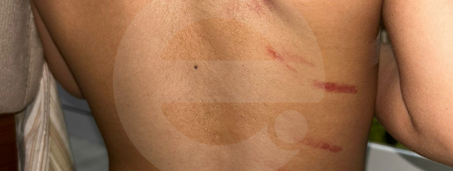 Homem que chamou filho autista de bichado é acusado de agredi-lo em Iracemápolis