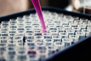 Pesquisas brasileiras avançam no diagnóstico de Alzheimer