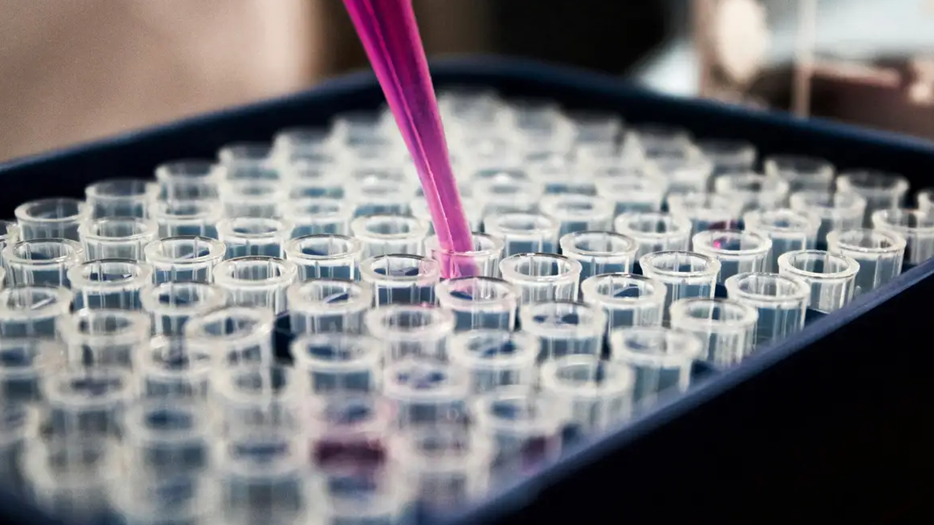 Pesquisas brasileiras avançam no diagnóstico de Alzheimer