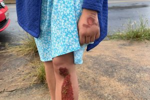 Casal fica ferido após ser atingido por caminhonete, em Limeira