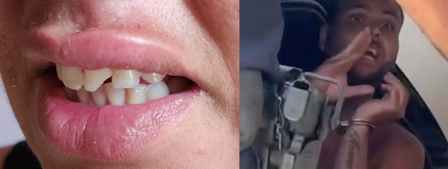 Homem é preso após agredir e quebrar dentes de ex no Jd. Boa Esperança, em Limeira