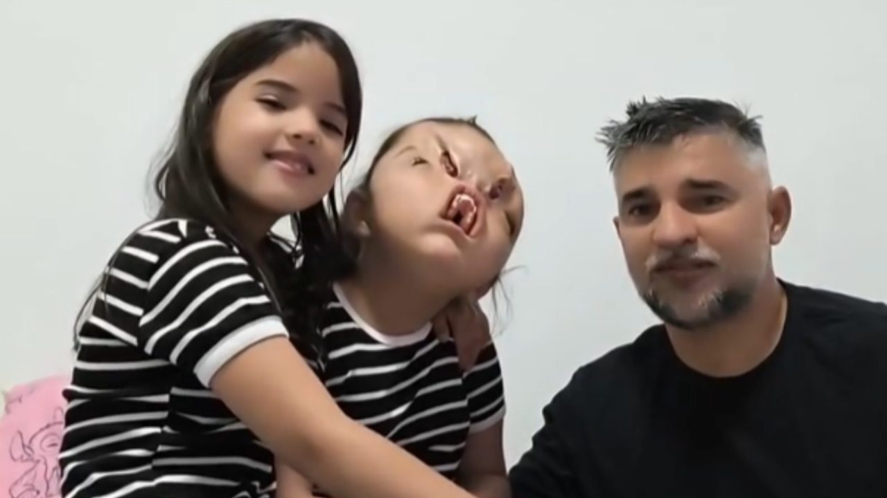 Pai de criança com síndrome rara pede ajuda