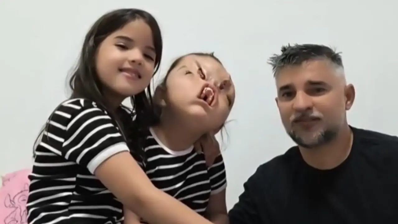 Pai de criança com síndrome rara pede ajuda
