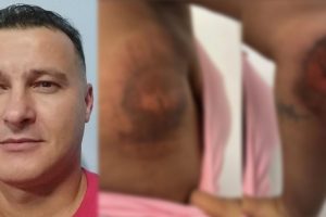 Homem que arrastou garota de programa é preso pela DIG