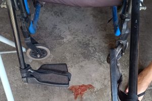 Idosa é encontrada ferida e em situação insalubre dentro de casa em Limeira (1)