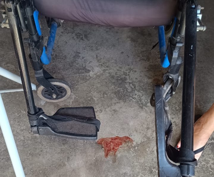 Idosa é encontrada ferida e em situação insalubre dentro de casa em Limeira (1)