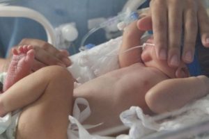 Limeira começa a aplicar anticorpo contra bronquiolite em bebês