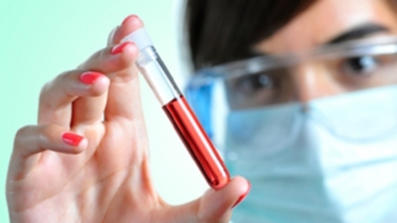 Limeira promove campanha de prevenção e conscientização sobre anemia falciforme