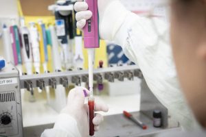 Suspeita de Ebola – Governo de SP