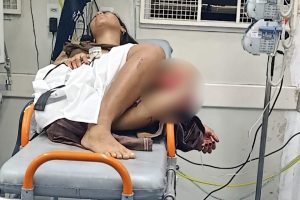 Jovem é investigado após atropelar 3 pessoas na zona rural de Limeira; mulher teve perna esmagada