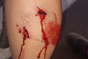 Ciclista é atacada por pitbull solto próximo ao CR em Limeira