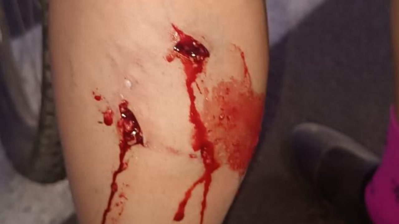 Ciclista é atacada por pitbull solto próximo ao CR em Limeira